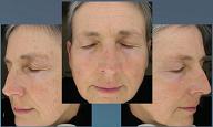 Complete Facial Analysis